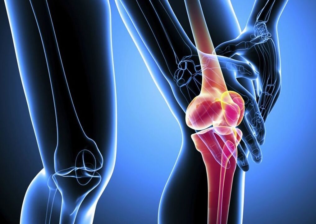 Fájdalom a fizikai aktivitás során a térdízület osteoarthritisében