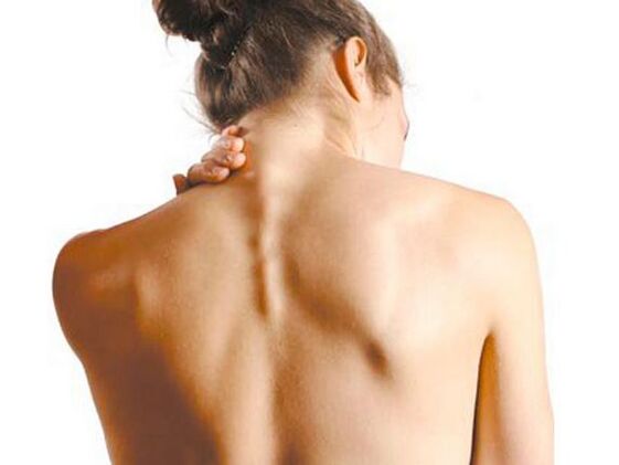 A lánynak nyaki osteochondrosisa van