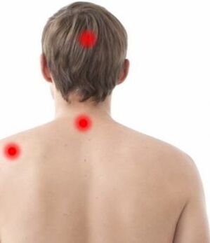 a fájdalom helye a nyaki osteochondrosisban