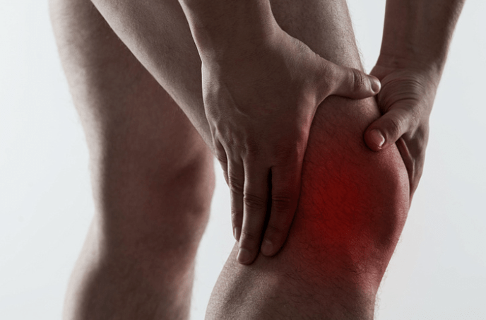 arthrosis mi az