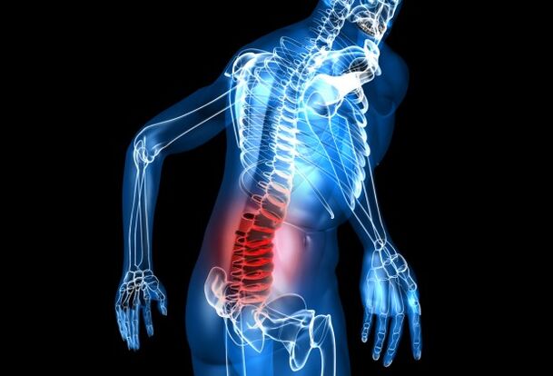 mi az ágyéki osteochondrosis